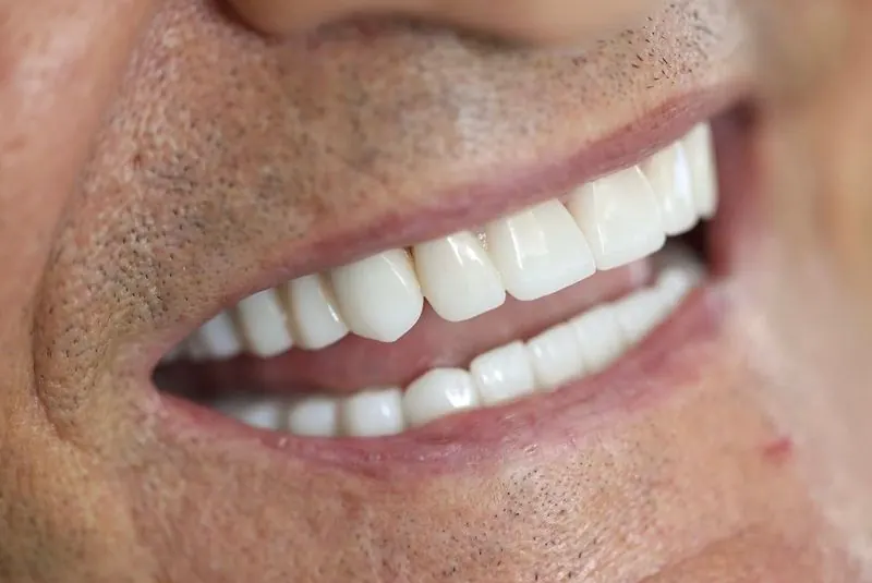 Hollywood Smile treatment room